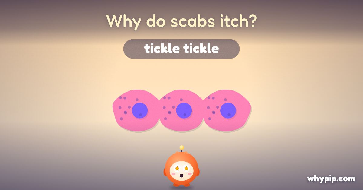 Pip’s picture for “Why do scabs itch?”